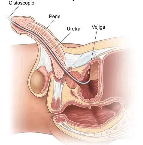 Todo lo que debes saber sobre el esfínter estriado de la uretra